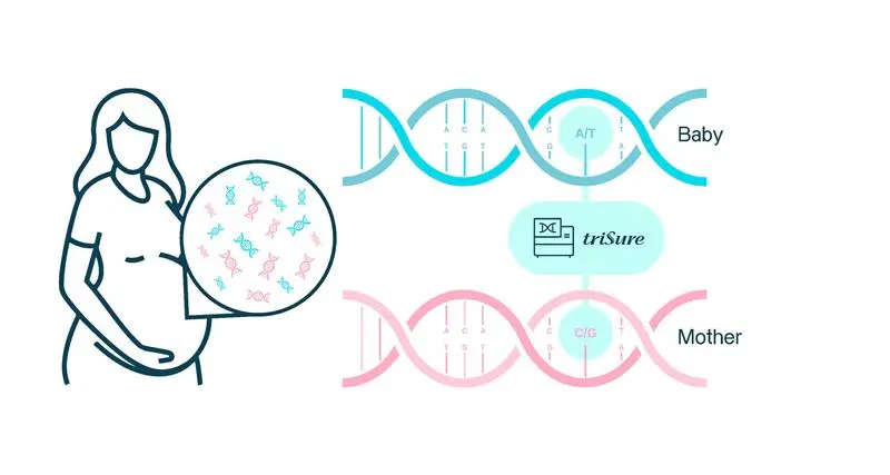 The uniqueness of triSure algorithm and technical process.